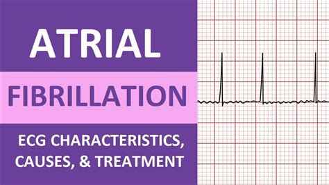 Treatment of atrial fibrillation: a comprehensive review and .